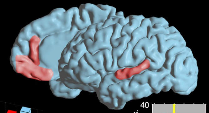 This image highlights two language areas in the brain where cell responses during speech were researched and mapped out. Image courtesy of Ariel Tankus