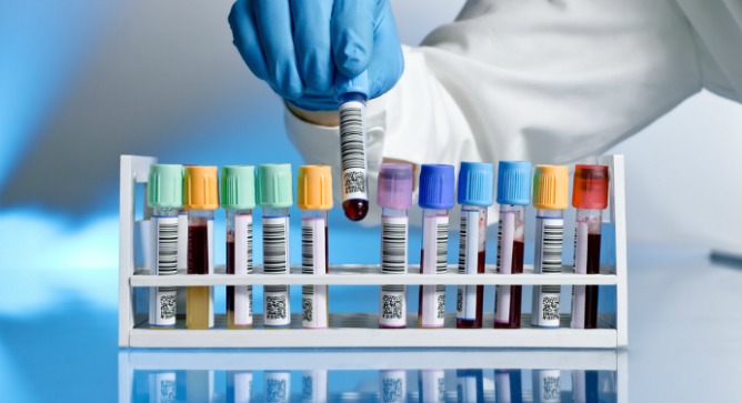 Contaminated blood could serve as diagnostic predictor for more targeted antibiotics. Image via Shutterstock.com