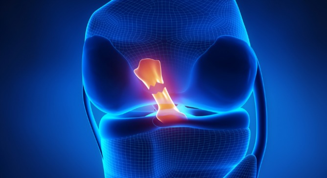 An anterior cruciate ligament. Image via Shutterstock.com.