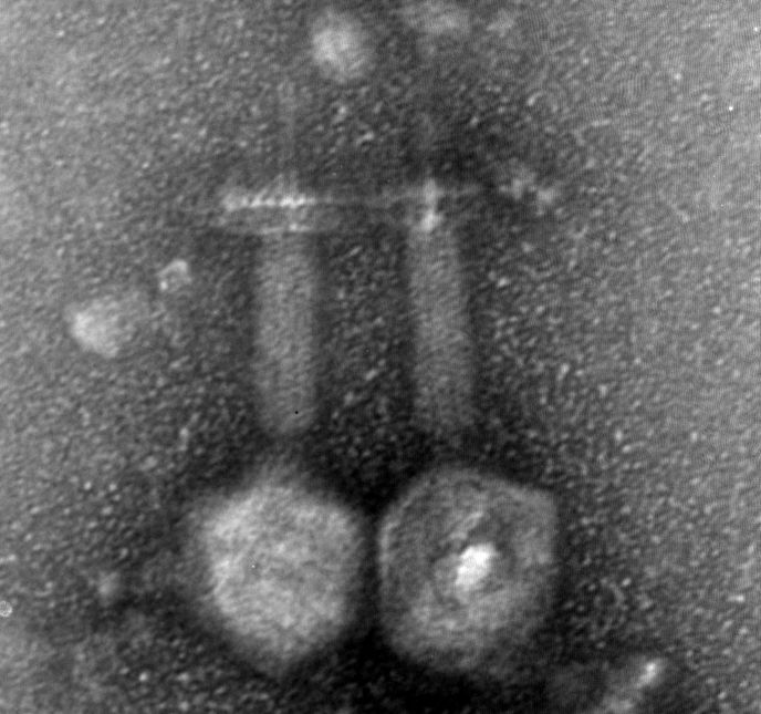 Bacteriophage EFDG1 at a magnification of 20,000 to 30,000 times. Some phages are still bound to remains of the dead bacteria. (Photo: Ronen Hazan/Hebrew University)