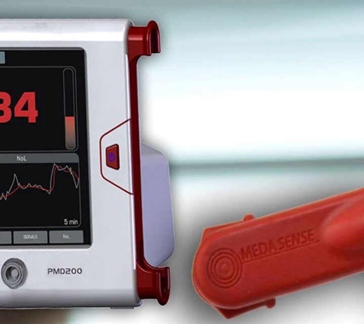 Medasense’s finger-mounted sensor records relevant physiological signs, and algorithms convert this data into a real-time, continuous pain index displayed on a bedside monitor. Photo courtesy