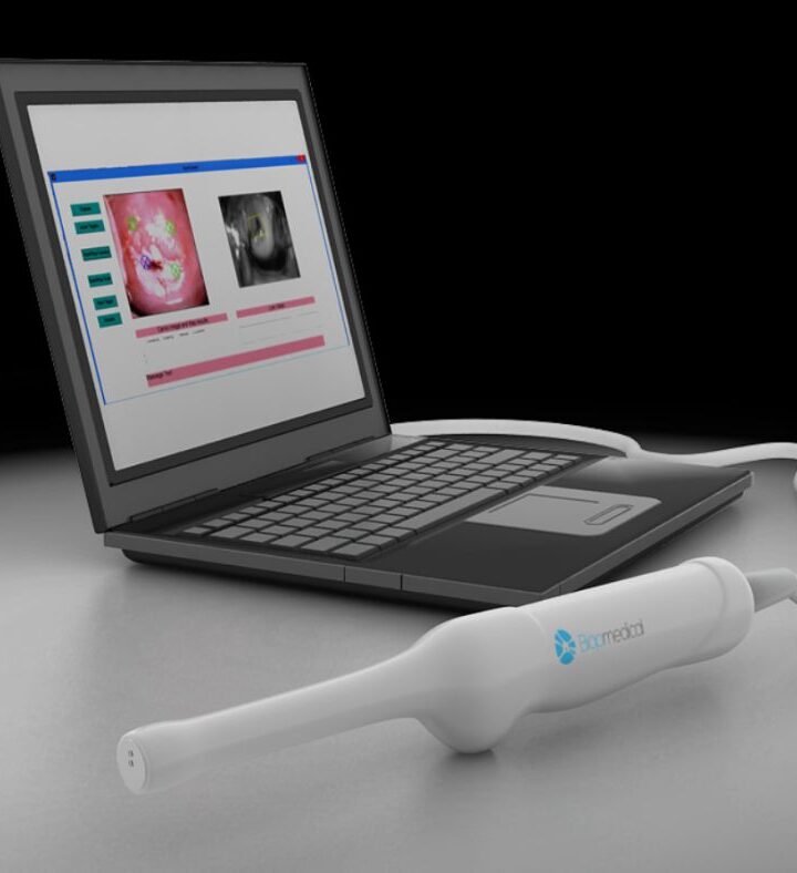 Biop Medical is designing a state-of-the-art colposcope to check women for gynecological disease. Photo: courtesy