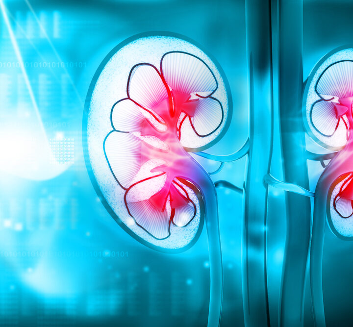 Galil Medical delivers innovative cryotherapy solutions for kidney cancer. Photo via Shutterstock.com