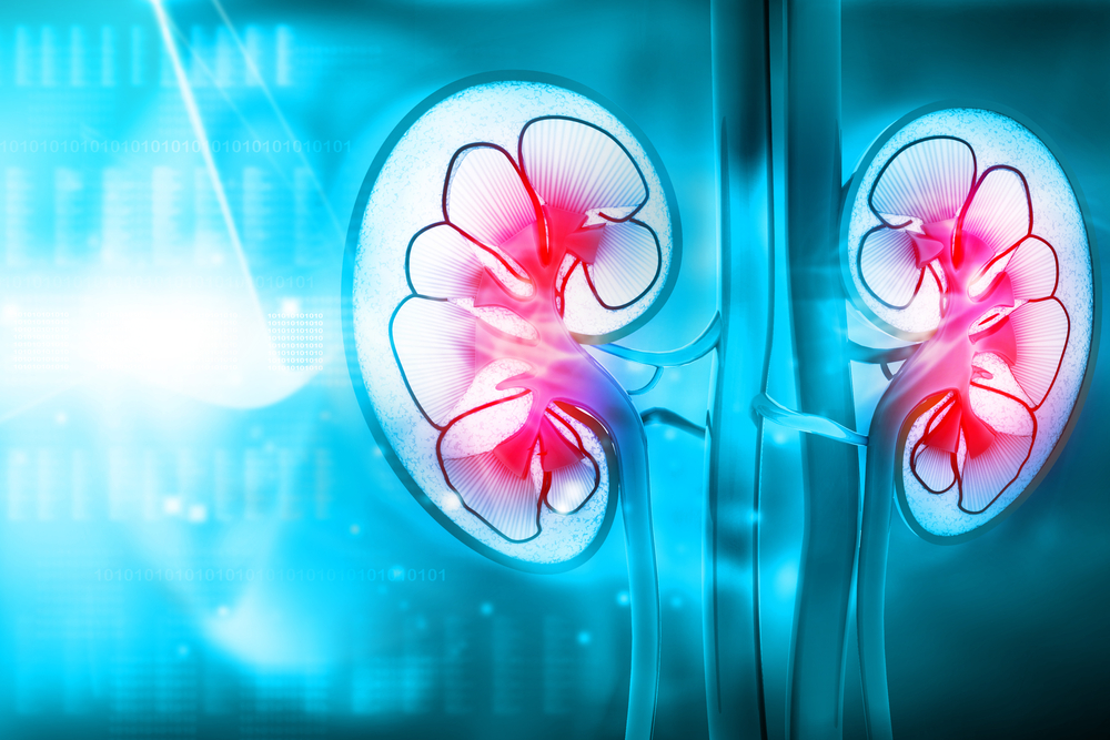 Galil Medical delivers innovative cryotherapy solutions for kidney cancer. Photo via Shutterstock.com