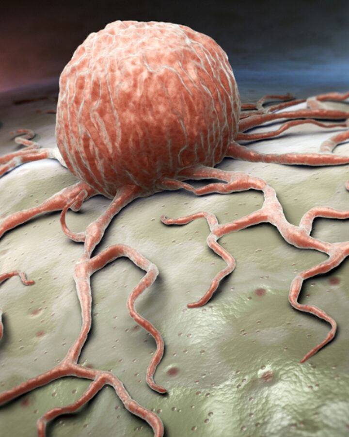 Image of cancer cell by Tatiana Shepeleva/Shutterstock