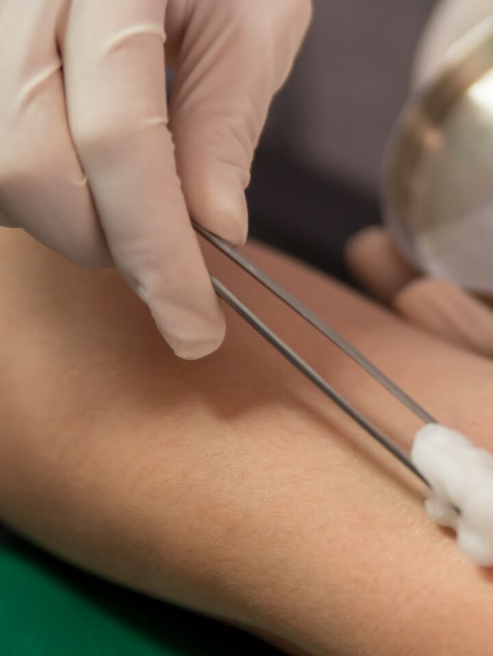 BGU and Cincinnati Children's Hospital hope to commercialize a device for precise placement of needles. Photo via Shutterstock.com