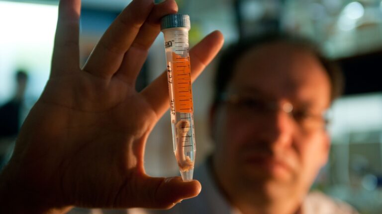 Shai Meretzki, CEO of Bonus BioGroup, with lab-grown human bone tissue. Photo: courtesy