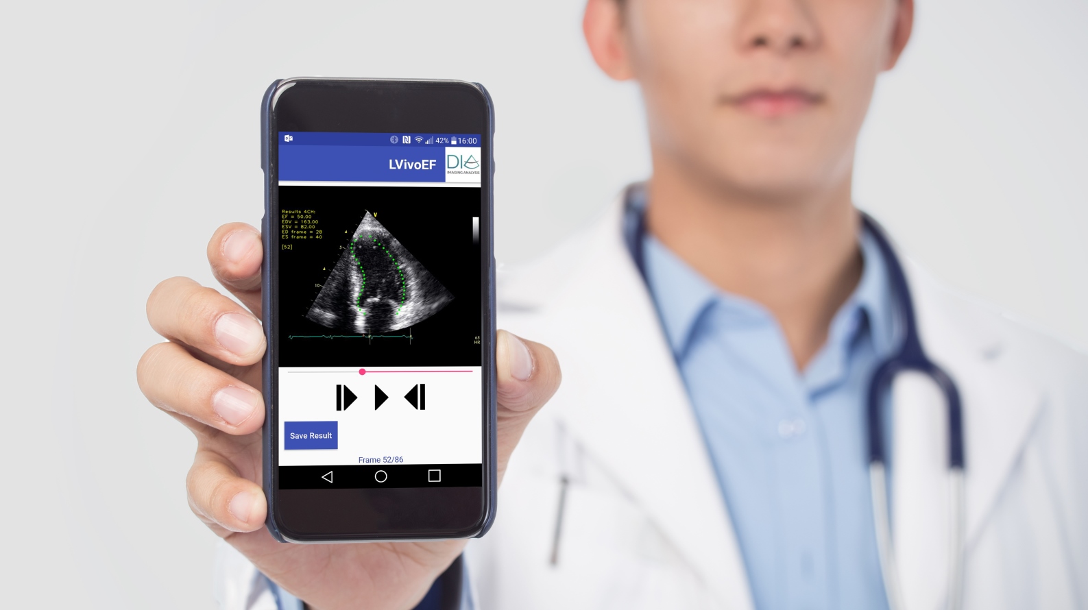 DiA’s automated tools for ultrasound analysis on mobile devices. Photo: courtesy