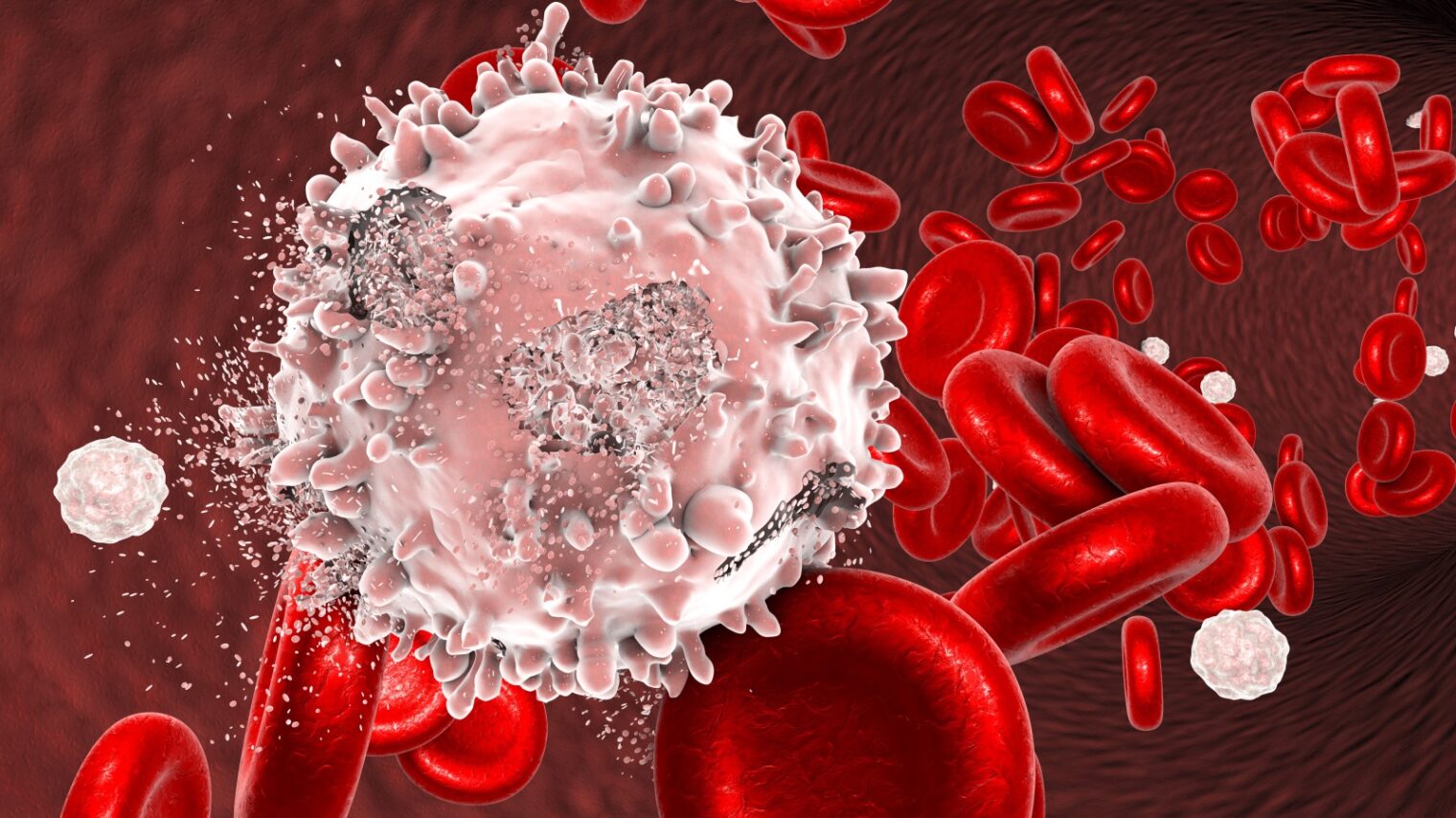 3D illustration showing the destruction of a leukemia cell by Kateryna Kon/Shutterstock.com