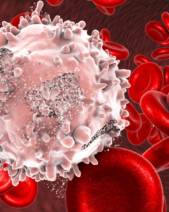 3D illustration showing the destruction of a leukemia cell by Kateryna Kon/Shutterstock.com