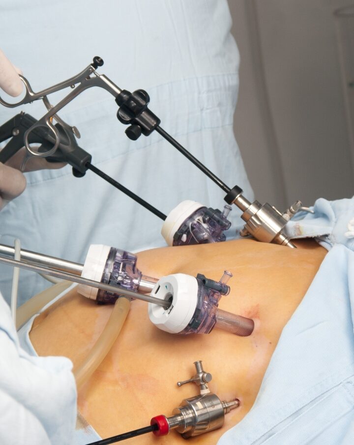 Gastric bypass surgery photo via Shutterstock.com