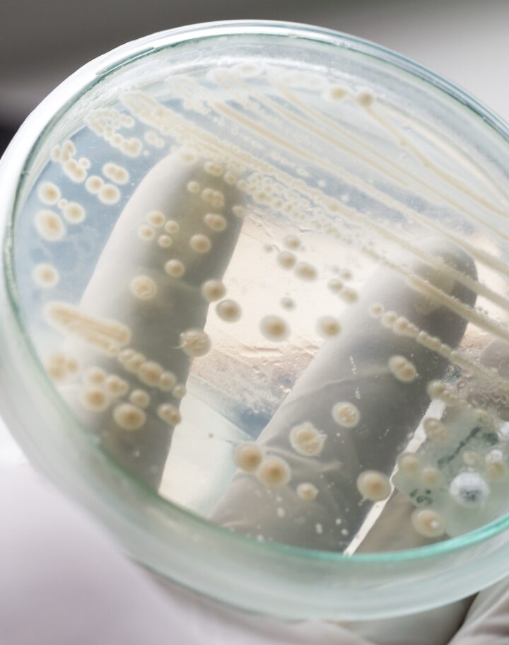 Yeast in a petri dish. Photo by Rattiya Thongdumhyu via Shutterstock.com