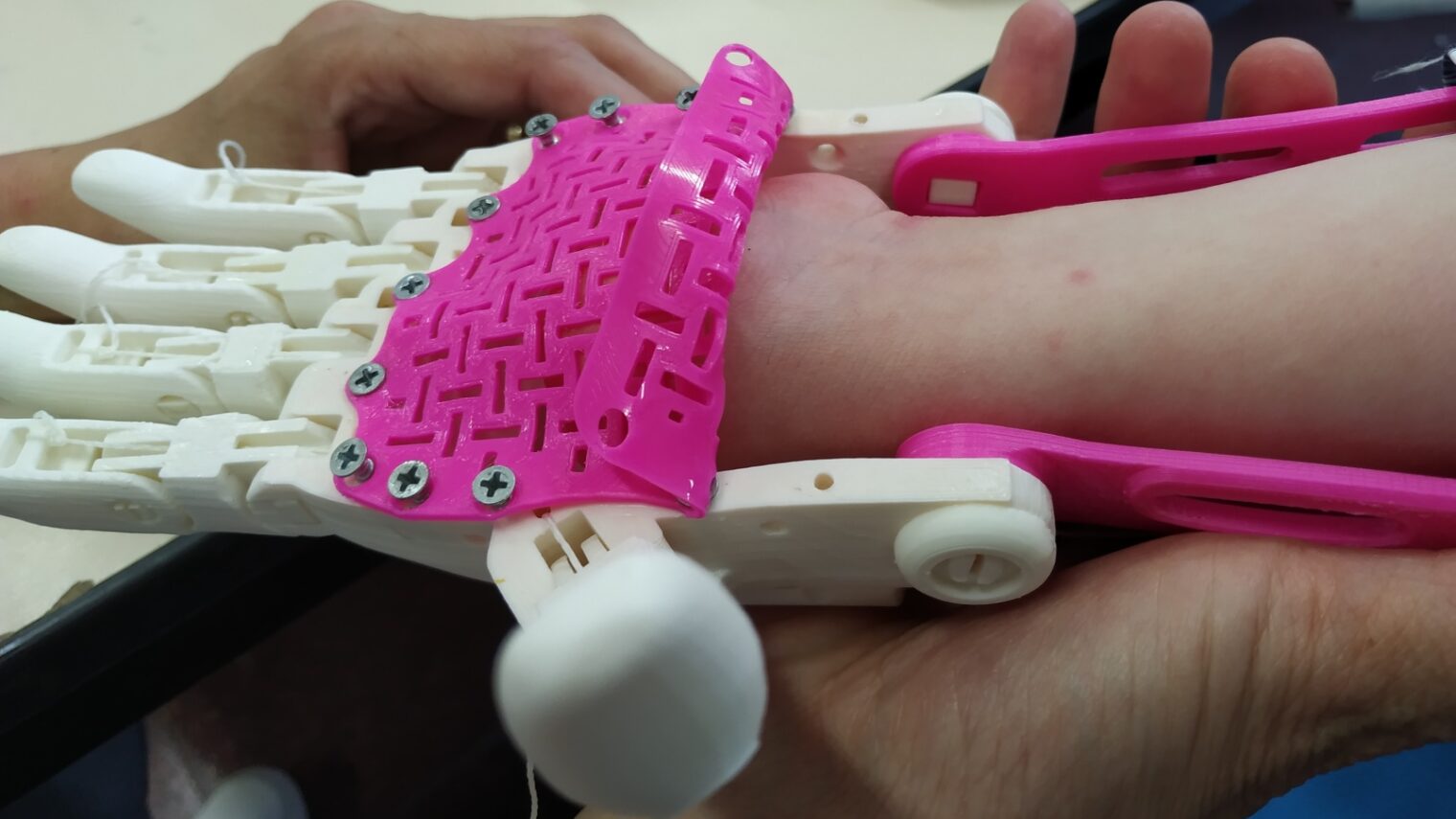 A young girl is fitted with a brightly colored 3D printed arm by Haifa 3D. Photo: courtesy