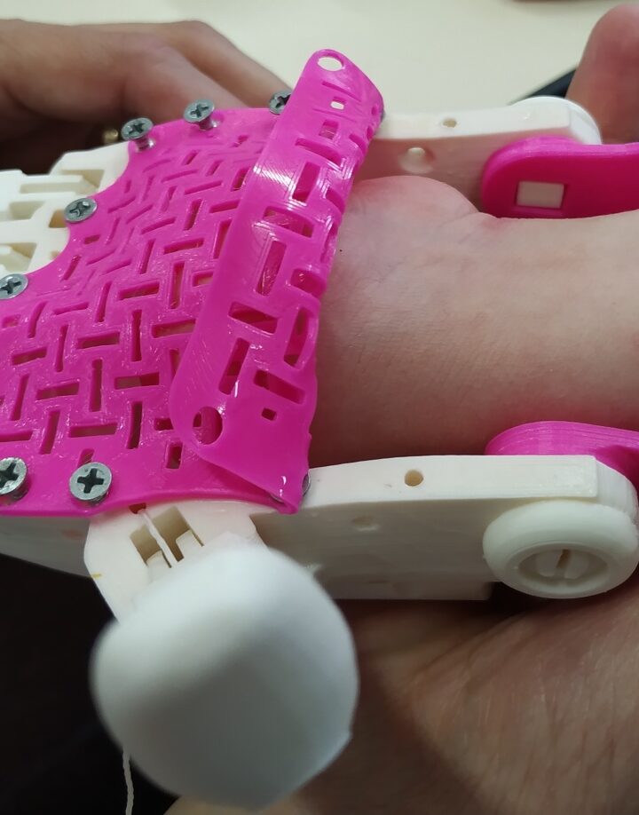 A young girl is fitted with a brightly colored 3D printed arm by Haifa 3D. Photo: courtesy