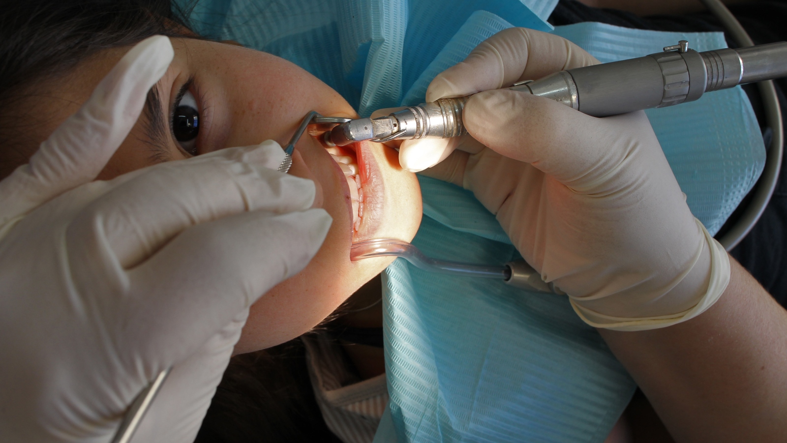 A young dental patient in Jerusalem. Photo by Nati Shohat/FLASH90