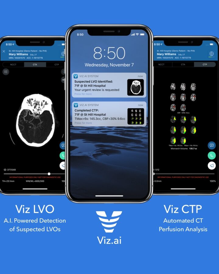 Viz.ai offers a technological solution for spotting large vessel occlusions and coordinating treatment quickly for stroke patients. Photo: courtesy