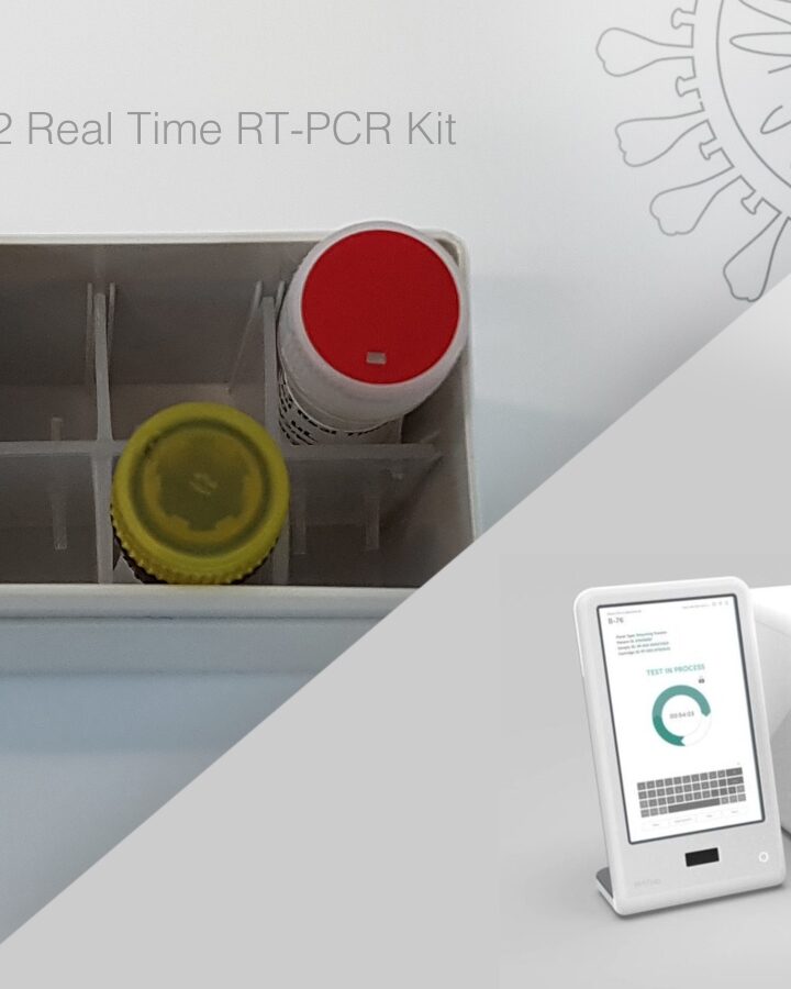 BATM is developing an RT-PCR rapid diagnostic kit for coronavirus. Photo: courtesy