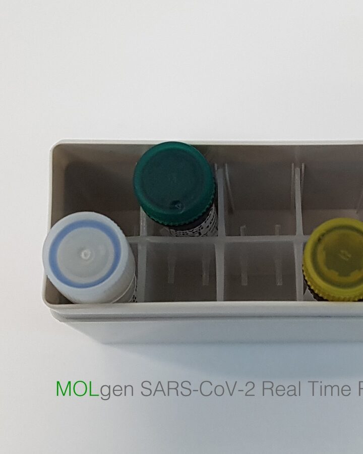 BATM’s fast-results RT-PCR kit for SARS-CoV-2. Photo: courtesy