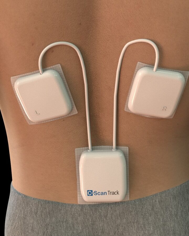 C-Scan’s noninvasive tracking system. Image courtesy of Check-Cap