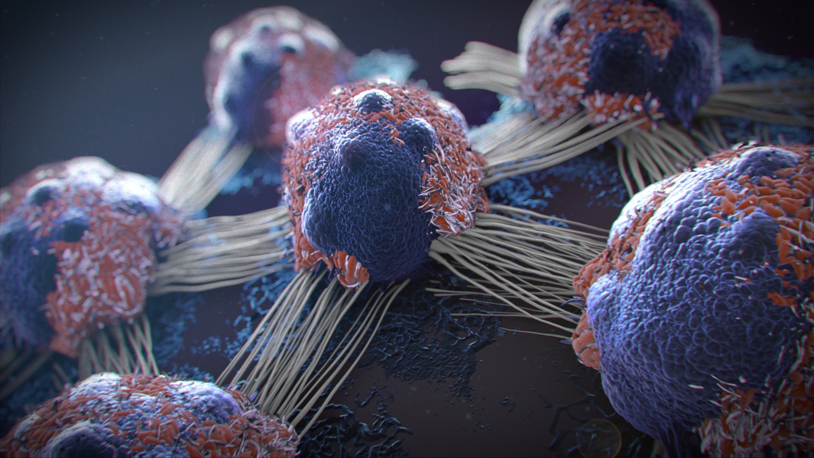 Photo of cancer cells by Javier Regueiro via Shutterstock.com