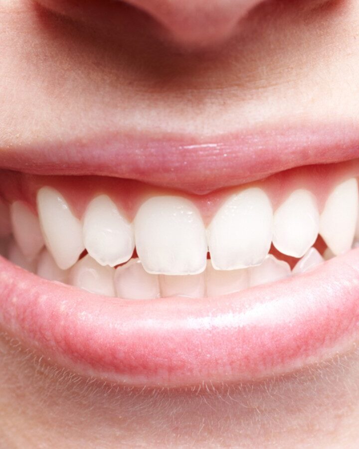 Good oral hygiene is important to avoid gum infection. Photo by Robert Kneschke/Shutterstock.com
