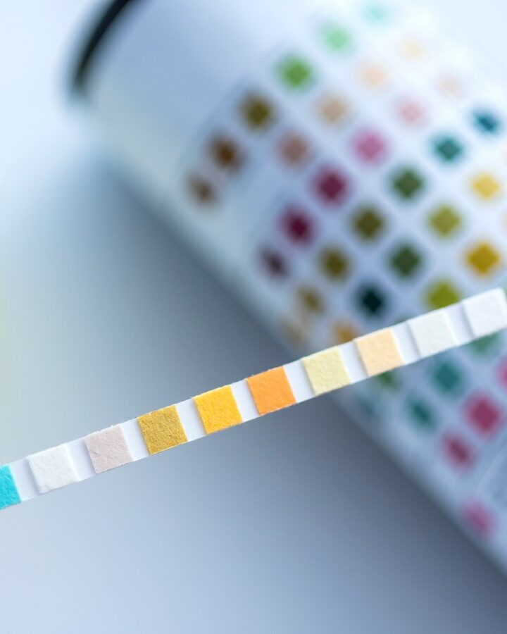 Olive Diagnostics wants to provide a urinalysis solution that is hassle-free and doesn’t involve fiddling around with sticks. Photo by AnaLysiSStudiO via Shutterstock.com