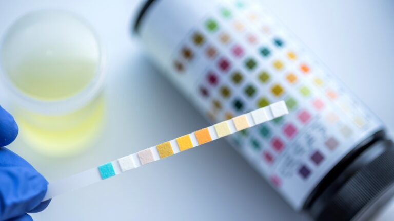 Olive Diagnostics wants to provide a urinalysis solution that is hassle-free and doesn’t involve fiddling around with sticks. Photo by AnaLysiSStudiO via Shutterstock.com