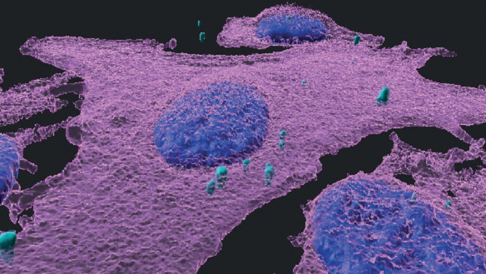 A 3D immunofluorescent image of melanoma cells (magenta) infected with bacteria (turquoise); cell nuclei are blue. Image courtesy of Weizmann Institute of Science