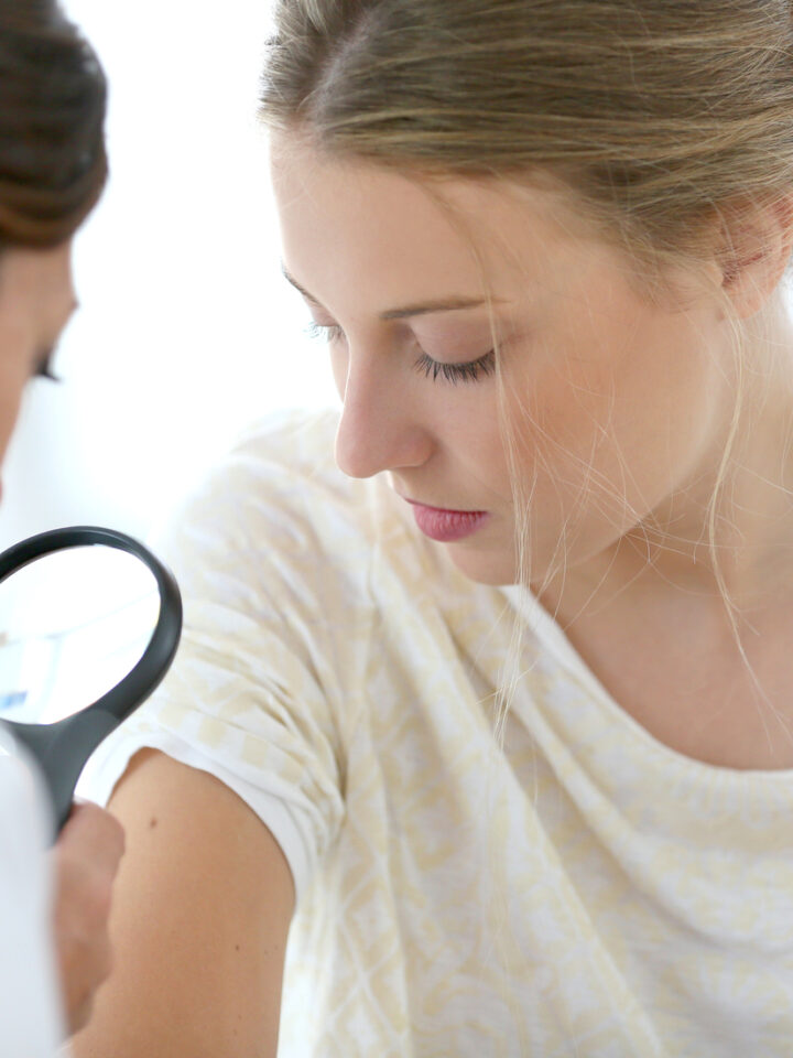Early diagnosis of skin cancer can save lives. Photo by Shutterstock