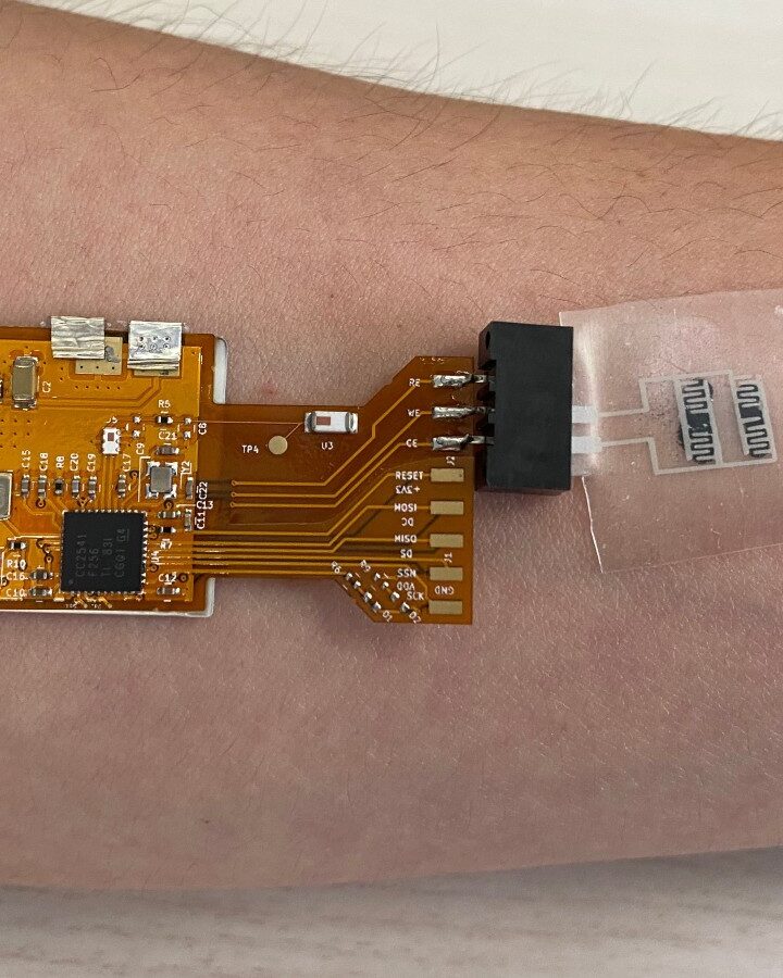 A-Patch skin adhesive system for sensing tuberculosis. Photo courtesy of Technion Spokesperson’s Office