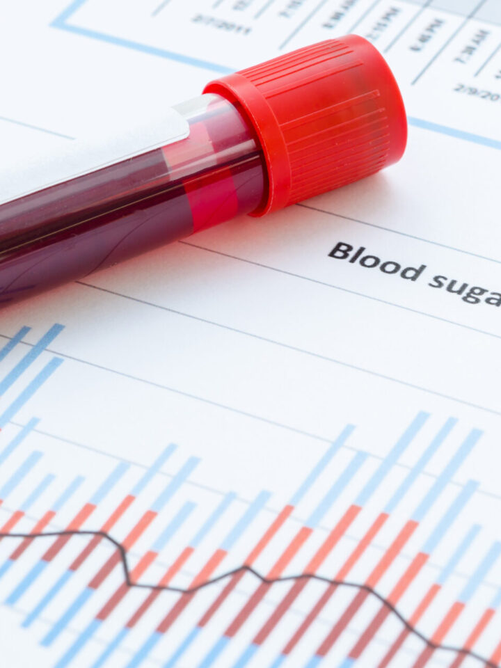 Patients with high blood sugar levels could be at more risk of serious Covid-19. Photo by Penpicks Studio, Shutterstock