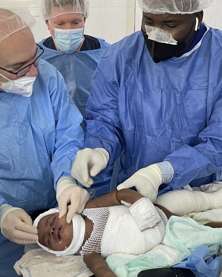 Dr. Josef Haik, second from left, working with Haitian physicians to treat a young burn victim, April 2022. Photo courtesy of Sheba Medical Center