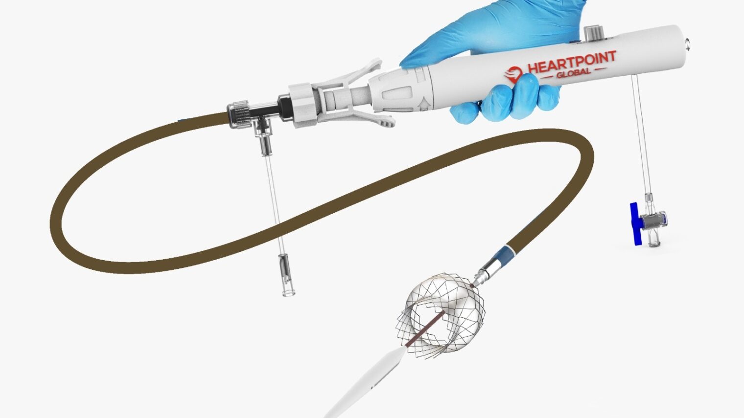 This stent system corrects blood flow and pressure abnormalities in the heart. Photo courtesy of HeartPoint Global