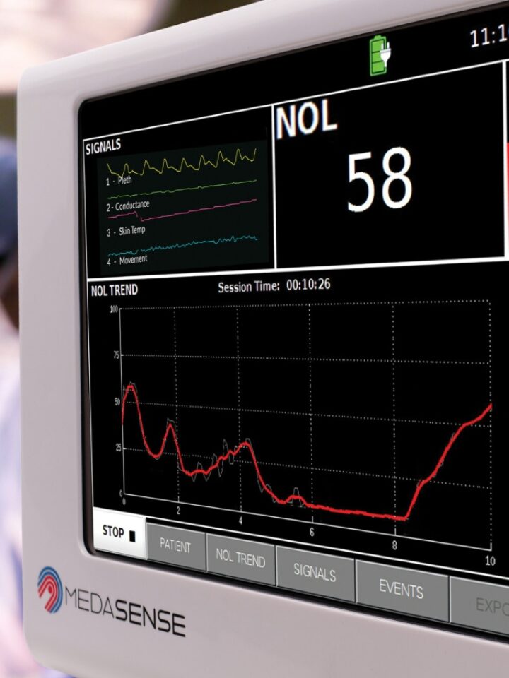 The FDA authorized PMD-200 monitor with NOL technology for measuring the physiological response to pain. Photo courtesy of Medasense