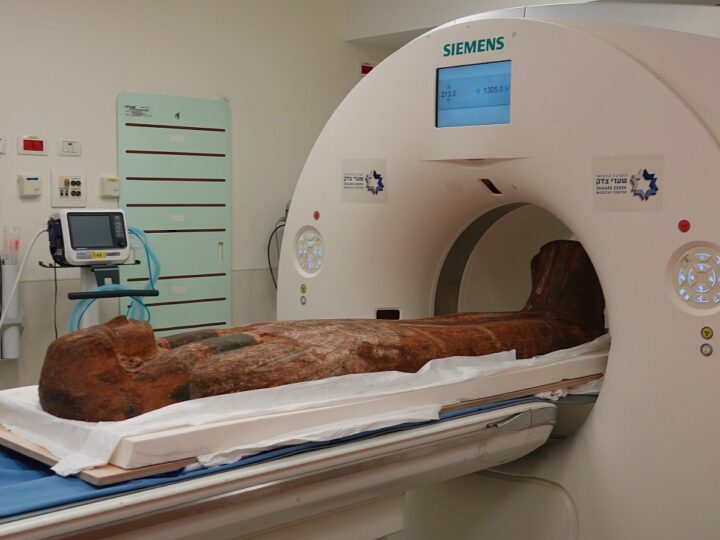 An unusual CT patient at Shaare Zedek Medical Center. Photo courtesy of Shaare Zedek Medical Center