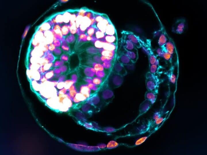 A stem cell–derived human embryo model at a developmental stage equivalent to that of a human embryo at day 12 has all the compartments typical of this stage. Photo courtesy of the Weizmann Institute of Science