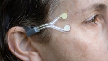 NeuroTrigger is a pacemaker for blinking in people with facial paralysis. Photo by Sraya Diamant