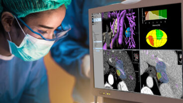 A physician performing ablation therapy with AI images from Techsomed on screen. Photo courtesy of Techsomed
