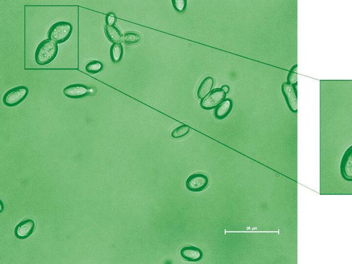 Kazachstania weizmannii, viewed under a microscope. Photo courtesy of the Weizmann Institute of Science
