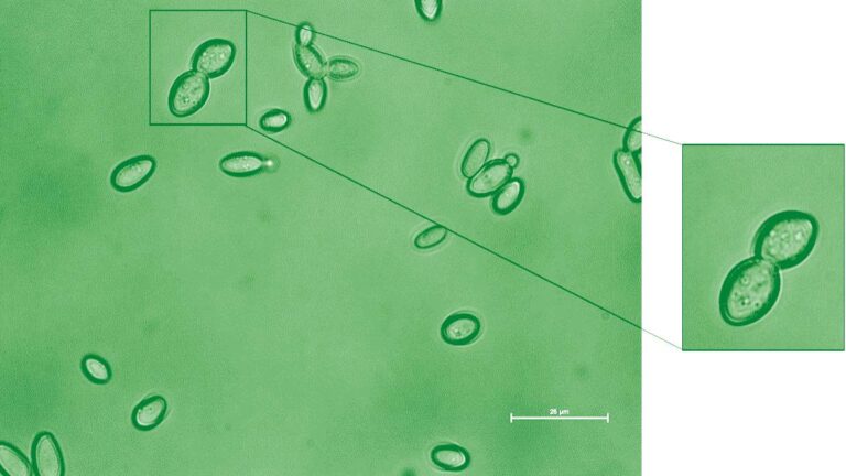 Kazachstania weizmannii, viewed under a microscope. Photo courtesy of the Weizmann Institute of Science.