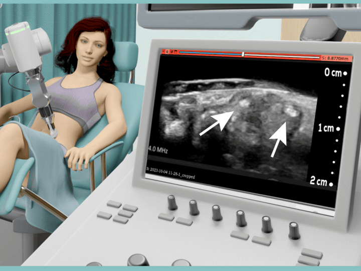 EndoCure is developing an ultrasound and AI system for diagnosing endometriosis. Image courtesy of EndoCure