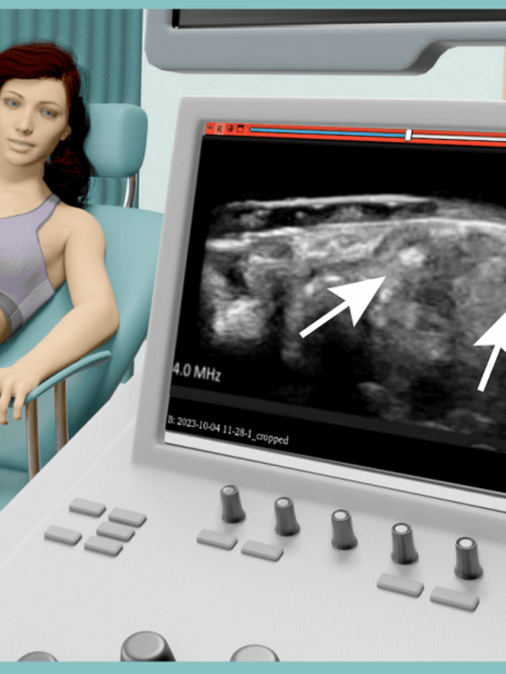 EndoCure is developing an ultrasound and AI system for diagnosing endometriosis. Image courtesy of EndoCure